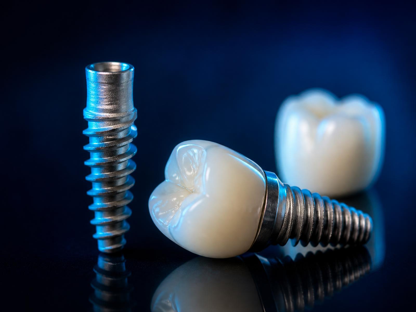 Restore & replace at Wolverhampton Dental