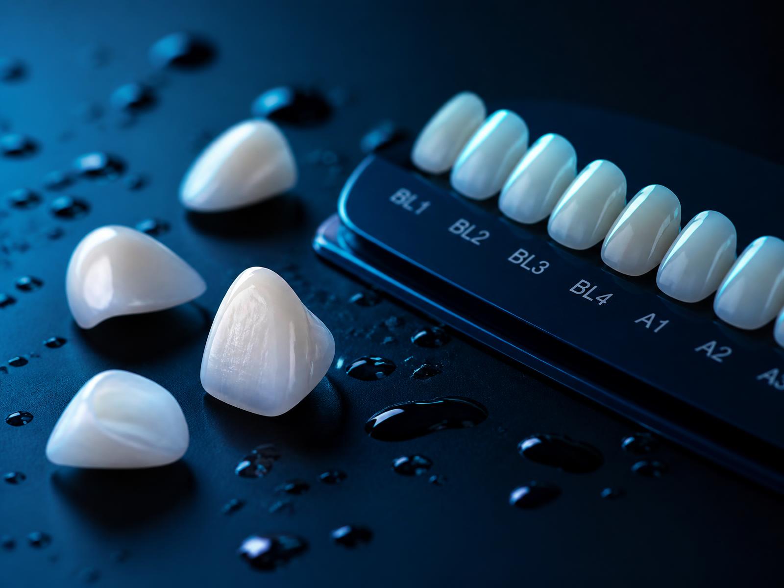 Whiten & reshape at Wolverhampton Dental